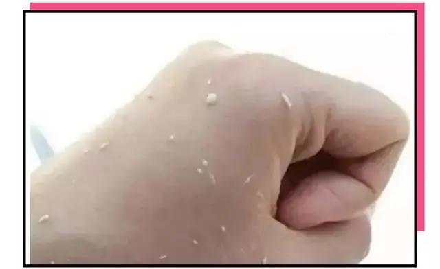 使用護膚品搓泥的原因有哪些？護膚品搓泥怎么辦？