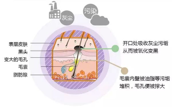 黑頭是怎么形成的？黑頭形成的原因有哪些？